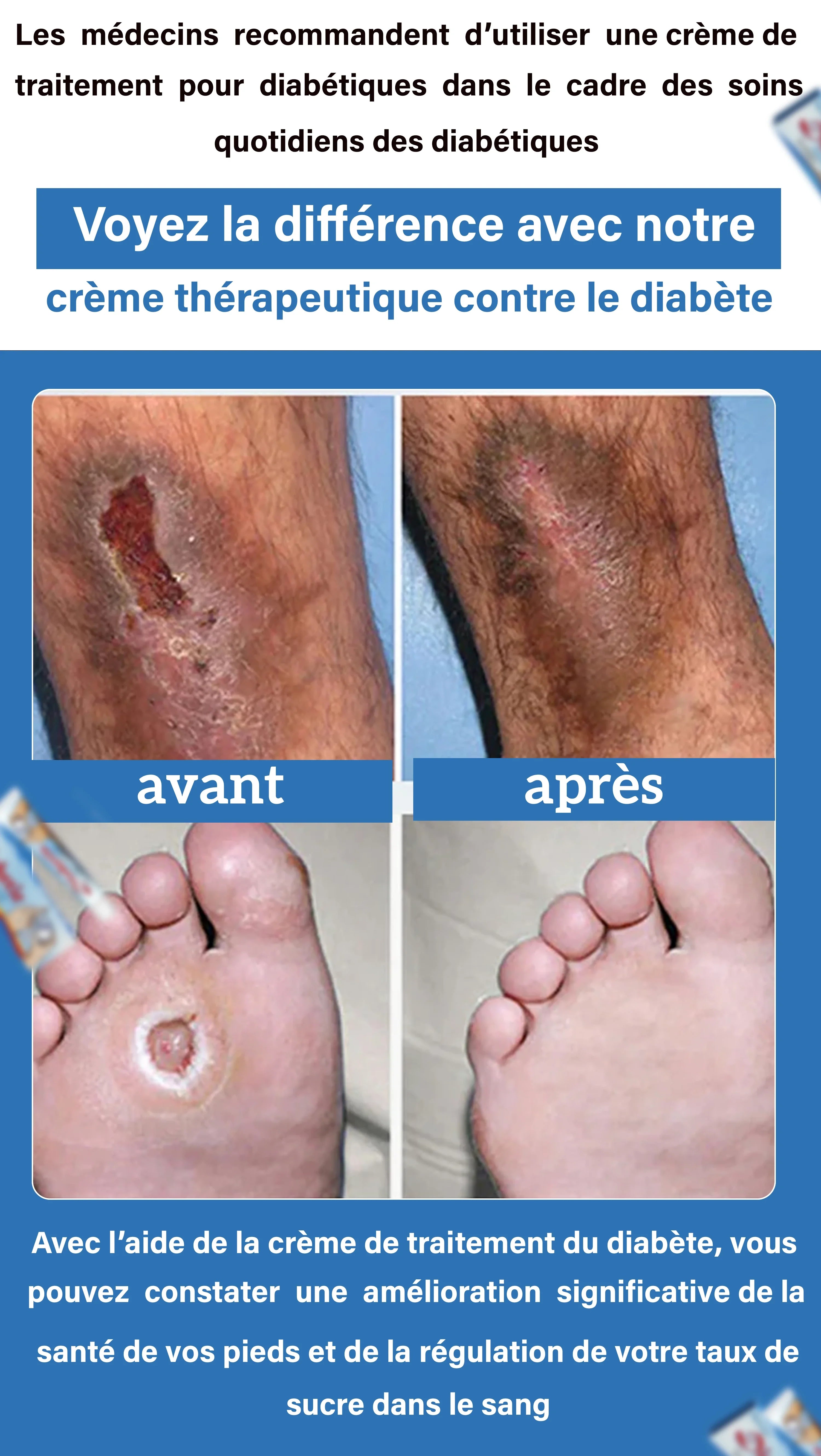 Crème Diabetic+